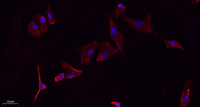 Immunofluorescence analysis of A549. 1,primary Antibody(red) was diluted at 1:200(4°C overnight). 2, Goat Anti Rabbit IgG (H&L) - Alexa Fluor 594 Secondary antibody was diluted at 1:1000(room temperature, 50min).3, Picture B: DAPI(blue) 10min.