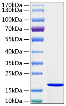 Recombinant Human IFN-gamma Protein was determined by SDS-PAGE under reducing conditions with Coomassie Blue.