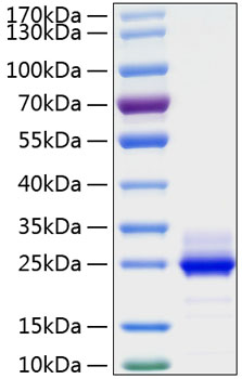 Immobilized Human IL6R at 1 μg/mL (100 μL/well) can bind Human IL-6 with a linear range of 2-15 ng/mL.