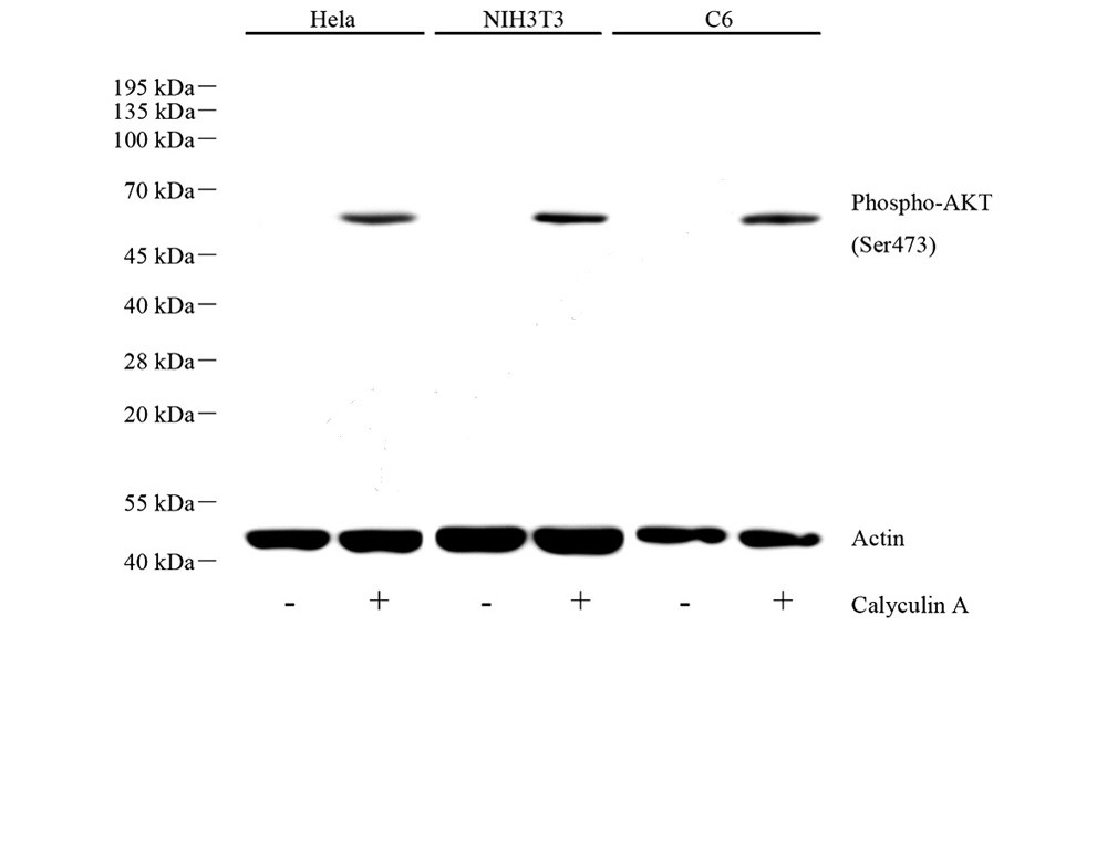 WB analysis of Phospho-AKT(S473). Sample: Protein treated by RIPA Lysis Buffer. Blocking buffer: 3% Nonfat dry milk in TBST, RT, 1h. Primary antibody: 1: 2000, 4℃ overnight. Secondary antibody: HRP Goat Anti-Rabbit lgG 1: 3000, RT, 1h.
