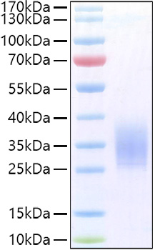 The purity of Human PTH1R/PTHR/PTHR1 Protein (Cat.GRF01369) was greater than 95% as determined by SEC-HPLC.