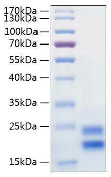 Immobilized Recombinant human IL17RA , His Tag at 2 μg/mL (100 μL/well) can bind Recombinant human IL-17A,The EC50 of human IL-17A is 32.5-130 ng/mL.