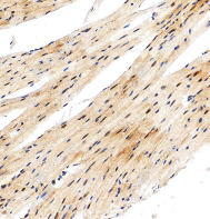 IHC analysis of FOXO1 antibody
Sample: Mouse heart, 4% PFA 12-24h.
Antigen retrieval: Tris-EDTA buffer (pH 9.0), 100℃ 25min.
Primary antibody: 1: 10000, 4℃ overnight.
Secondary antibody: S-vision poly-HRP conjugated Goat Anti-Rabbit lgG (H+L), Ready to use, RT, 20min.
