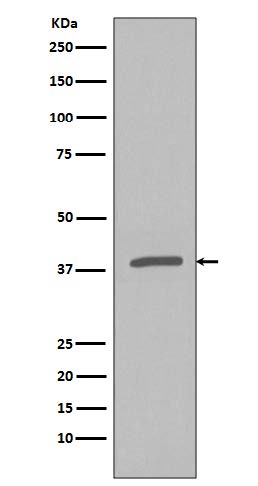 Western blot analysis of Phospho-IKB alpha (S32) in HeLa lysates treated with Calyculin A and TNFa using Phospho-IKB alpha (Ser32) antibody.