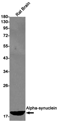 Western blot analysis of Alphasynuclein in rat Brain lysates using alpha Synuclein antibody.