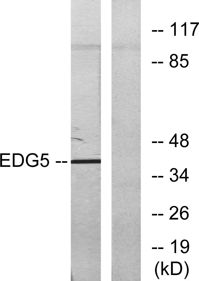 Western blot analysis of lysates from COLO205 cells, using EDG5 Antibody. The lane
on the right is blocked with the synthesized peptide.