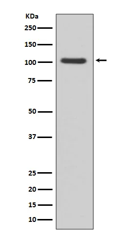 Western blot analysis of GluR1 expression in Human brain lysate.