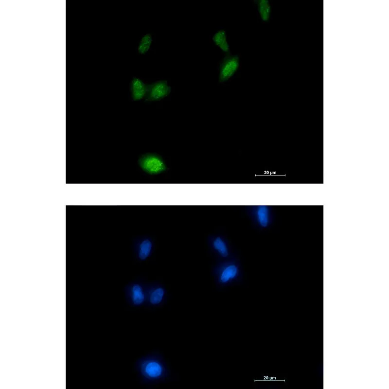 Immunocytochemistry analysis of Phospho-Amyloid Precursor Protein (Thr743) (green) in LNcap using Phospho-Amyloid Precursor Protein (Thr743) antibody, and DAPI (blue).