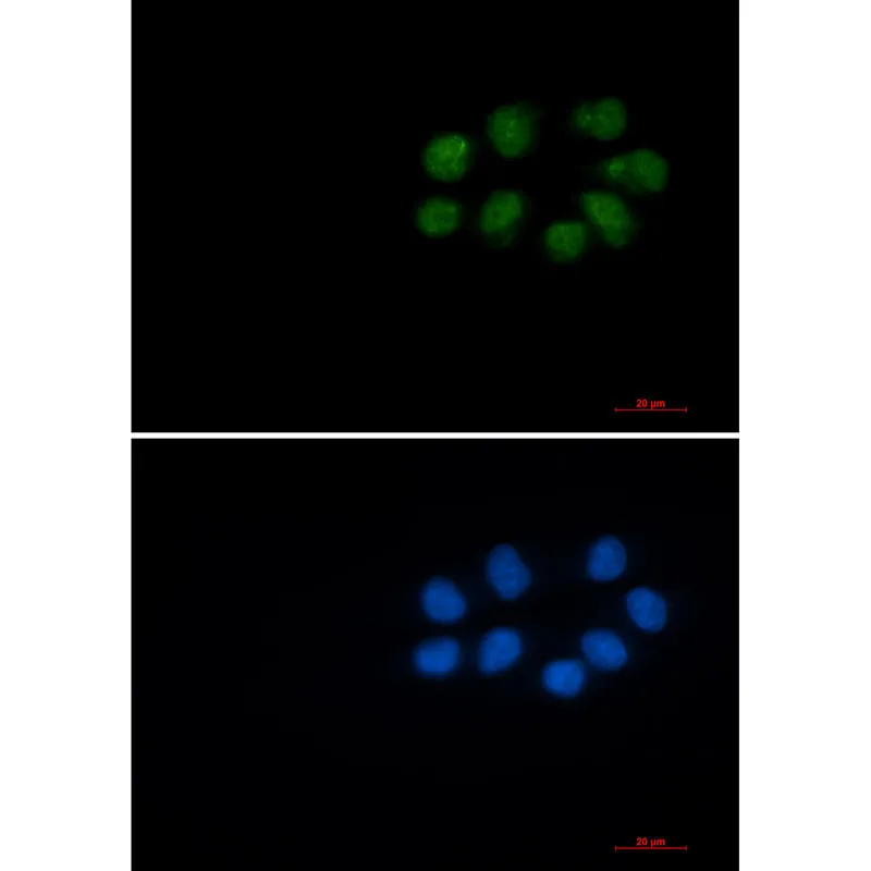 Immunocytochemistry analysis of Phospho-Vimentin (Ser56) (green) in Hela using Phospho-Vimentin (Ser56) antibody, and DAPI (blue).
