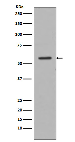 Western blot analysis of Tyrosine Hydroxylase expression in PC-3 cell lysate.