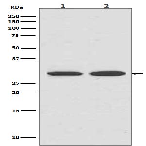Western blot analysis of Calreticulin in (1) HepG2 lysates; (2) Jurkat lysates using VDAC1 antibody.