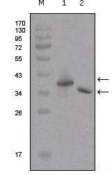 2ug Flag fusion protein+ Primary antibody dilution at 1:5000