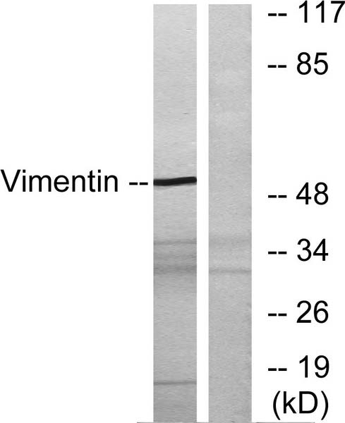 Western blot analysis of lysates from 293 cells, treated with EGF 200ng/ml 30‘, using Vimentin Antibody. The lane on the right is blocked with the synthesized peptide.