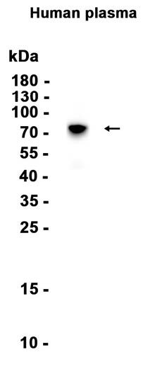 Western blot analysis of extracts from Human plasma tissue using Vitronectin Rabbit Polyclonal Antibody at 1:1000.