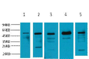 Western blot analysis of 1) Mouse skeletal muscle tissue, 2) Mouse kidney tissue, 3) Mouse Heart Tissue, 4) Mouse brain tissue, 5) Mouse Liver tissue, diluted at 1:2000.. Secondary antibody was diluted at 1:20000