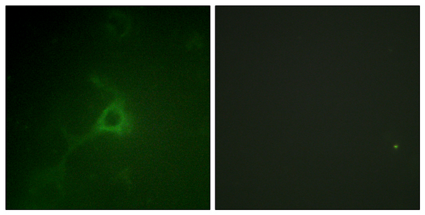 Immunofluorescence analysis of COS7 cells, using GFAP Antibody. The picture on the right is blocked with the synthesized peptide.