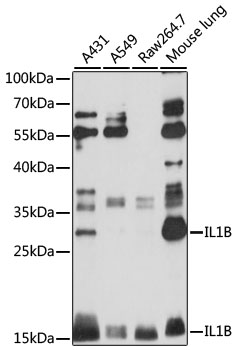 Western blot analysis of IL-1 beta in various cell lines lysates using IL-1B antibody.