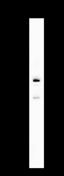 SH-SY5Y cell lysates were separated by 4-20% SDS-PAGE, and the membrane was blotted with Parkin Rabbit Polyclonal Antibody 1:1000. The HRP-conjugated Goat anti-Rabbit IgG(H + L) antibody was used to detect the antibody.