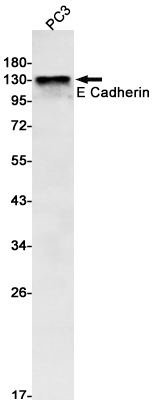 Western blot analysis of E Cadherin in PC-3 lysates using E Cadherin antibody.