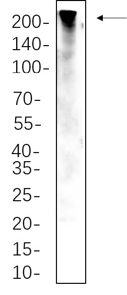 C2C12 whole cell lysates were separated by 10% SDS-PAGE, and the membrane was blotted with ZO1 Rabbit Monoclonal Antibody(1:1000). The HRP-conjugated Goat anti-Rabbit IgG(H + L) antibody was used to detect the antibody.