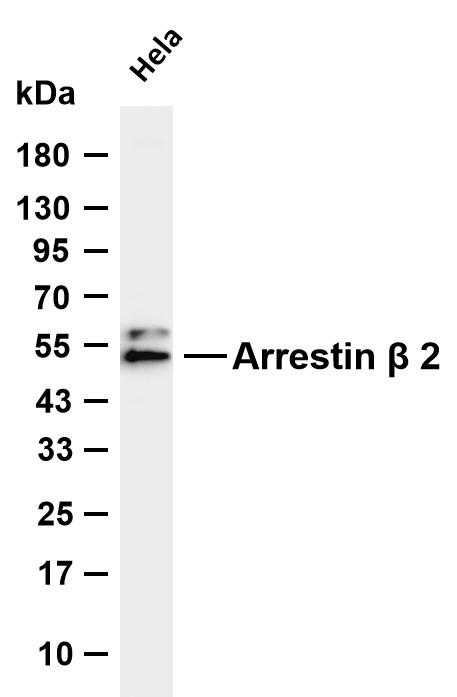 Various whole cell lysates were separated by 4-20% SDS-PAGE, and the membrane was blotted with anti-Arrestin β2 antibody. The HRP-conjugated Goat anti-Rabbit IgG(H+L) antibody was used to detect the antibody.