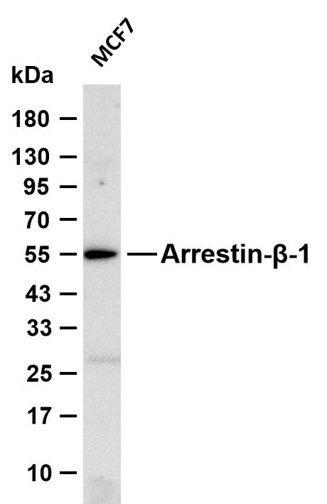 Various whole cell lysates were separated by 4-20% SDS-PAGE, and the membrane was blotted with anti-Arrestin-β-1 antibody. The HRP-conjugated Goat anti-Rabbit IgG(H+L) antibody was used to detect the antibody.