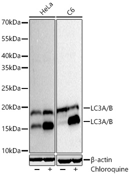 Western blot analysis of various lysates using LC3A/LC3B Rabbit Monoclonal Antibody  at 1:10000 dilution incubated at room temperature for 1.5 hours. Hela and C6 cells were treated with Chloroquine (50 μM) at 37℃ for 20 hours.