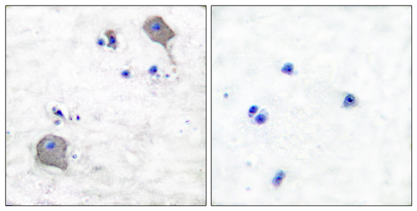 Immunohistochemistry analysis of paraffin-embedded human brain tissue, using Claudin 5 Antibody. The picture on the right is blocked with the synthesized peptide.