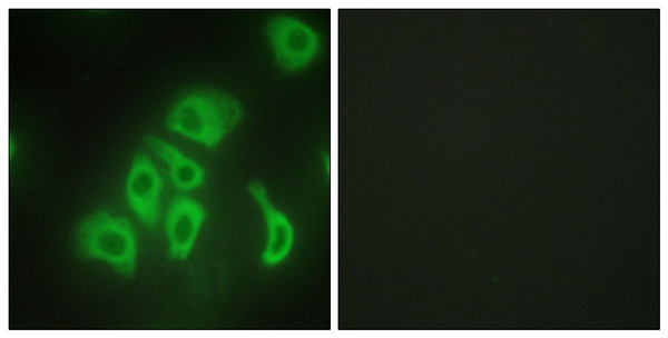 Immunofluorescence analysis of HepG2 cells, using TNFA Antibody. The picture on the right is blocked with the synthesized peptide.