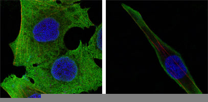 Western blot analysis using SOD1 mouse mAb against Hela (1), NIH/3T3 (2), A549 (3) and A431 (4) cell lysate.