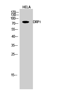 Western blot analysis of DRP1 in Hela lysates using DRP1 antibody.