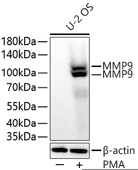 Western blot analysis of lysates from U-2 OS cells usingMMP9 Rabbit pAb at 1:5000 dilution incubatedat room temperature for 1.5 hours. U-2 OS cells were treated with PMA (200 nM) at 37℃ for 48 hours after serumstarvation
overnight.|Secondary antibody: HRP-conjugatedGoat anti-Rabbit IgG (H+L) at 1:10000 dilution.|Lysates/proteins: 30 μg per lane.| Blocking buffer: 3% nonfatdry milk in TBST.|
Detection: ECL West Pico Plus.
Exposure time: 20 s.