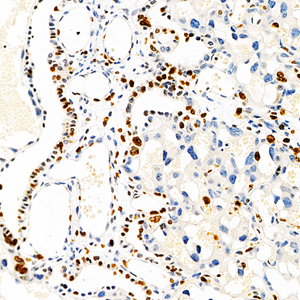 IHC analysis of ki67 (GB111141).<br/>Sample: Mouse placenta (Paraffin), 4% PFA (G1101) 12-24h.<br/>Antigen retrieval: Citrate buffer (pH 6.0) (G1201), pressure cooker 2min.<br/>Blocking buffer: 3% BSA in PBS (GC305010), RT, 30min.<br/>Primary antibody: 1: 1000, 4℃ overnight.<br/>Secondary antibody: HRP Goat Anti-Rabbit lgG (GB23303), 1: 200 RT 1h.