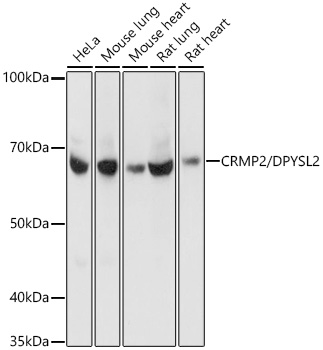Western blot analysis of extracts of various cell lines, using CRMP2/DPYSL2 Rabbit mAb  at 1:1000 dilution.Secondary antibody: HRP Goat Anti-Rabbit IgG   at 1:10000 dilution.Lysates/proteins: 25μg per lane.Blocking buffer: 3% nonfat dry milk in TBST.Detection: ECL Basic Kit .Exposure time: 3s.