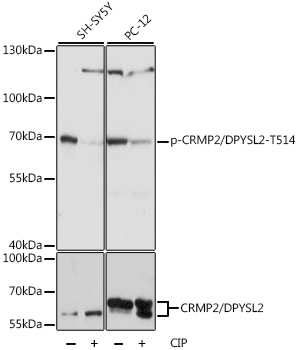 Western blot analysis of various lysates using Phospho-CRMP2/DPYSL2-T514 Rabbit pAb  at 1:1000 dilution or CRMP2/DPYSL2 antibody . SH-SY5Y cells were treated by CIP at 37℃ for 1 hour. PC-12 cells were treated by CIP at 37℃ for 1 hour.
Secondary antibody: HRP Goat Anti-Rabbit IgG   at 1:10000 dilution.
Lysates/proteins: 25μg per lane.
Blocking buffer: 3% BSA.
Detection: ECL Basic Kit .
Exposure time: 1s.