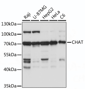 Western blot analysis of various lysates, using CHAT Rabbit pAb at 1:1000 dilution.
Secondary antibody: HRP-conjugated Goat anti-Rabbit IgG at 1:10000 dilution.
Lysates/proteins: 25μg per lane.
Blocking buffer: 3% nonfat dry milk in TBST.
Detection: ECL Basic Kit .
Exposure time: 5s.