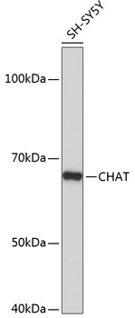 Western blot analysis of lysates from SH-SY5Y cells, using CHAT Rabbit mAb at 1:1000 dilution.
Secondary antibody: HRP-conjugated Goat anti-Rabbit IgG at 1:10000 dilution.
Lysates/proteins: 25μg per lane.
Blocking buffer: 3% nonfat dry milk in TBST.
Detection: ECL Basic Kit .
Exposure time: 5s.