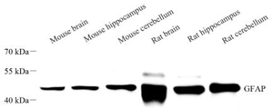 Western blot analysis of GFAP at dilution of 1: 1000