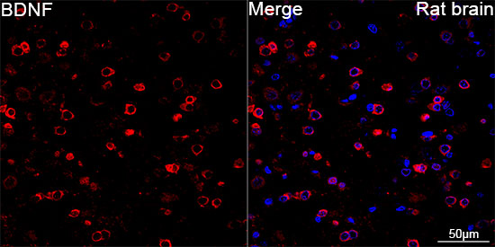 Confocal imaging of paraffin-embedded Rat brain using BDNF Rabbit mAb followed by a further incubation with Cy3 Goat Anti-Rabbit IgG .DAPI was used for nuclear staining . Objective: 40x. Perform microwave antigen retrieval with 0.01 M citRate buffer prior to IF staining.