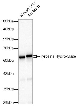 Western blot analysis of various lysates using Tyrosine Hydroxylase Rabbit mAb at 1:1000 dilution incubated overnight at 4℃.
Secondary antibody: HRP-conjugated Goat anti-Rabbit IgG at 1:10000 dilution.
Lysates / proteins: 25 μg per lane.
Blocking buffer: 3 % nonfat dry milk in TBST.
Detection: ECL Basic Kit .
Exposure time: 10s.
