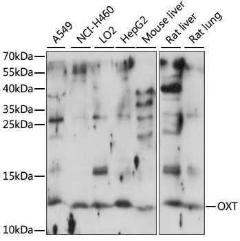 Western blot analysis of various lysates using OXT Rabbit pAb at 1:1000 dilution.
Secondary antibody: HRP-conjugated Goat anti-Rabbit IgG (H+L) at 1:10000 dilution.
Lysates/proteins: 25μg per lane.
Blocking buffer: 3% nonfat dry milk in TBST.
Detection: ECL Basic Kit .
Exposure time: 30s.
