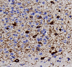 IHC analysis of TH . Sample: Mouse brain , 4% PFA 12-24h. Antigen retrieval: Citrate buffer ,98℃,20 min. Blocking buffer: 3% BSA in PBS , RT, 30min. Primary antibody: 1: 1500, 4℃ overnight. Secondary antibody: HRP Goat Anti-Mouse lgG , 1: 200 RT 1h.