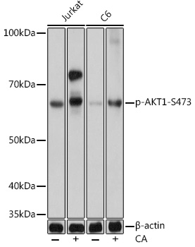Western blot analysis of various lysates using Phospho-AKT1-S473 mAb at 1:1000 dilution. Both Jurkat cells and C6 cells were treated by Calyculin A at 37℃ for 30 minutes.
Secondary antibody: HRP-conjugated Goat anti-Rabbit IgG at 1:10000 dilution.
Lysates/proteins: 25μg per lane.
Blocking buffer: 3% nonfat dry milk in TBST.
Detection: ECL Basic Kit .
Exposure time: 1s.