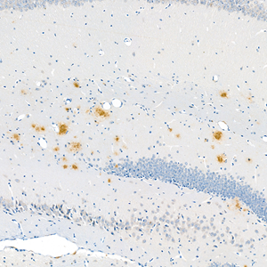 IHC analysis of Aβ40 . Sample: Mouse Alzheimer's brain , 4% PFA 12-24h. Antigen retrieval: Citrate buffer ,98℃,20 min. Blocking buffer: 3% BSA in PBS , RT, 30min. Primary antibody: 1: 400, 4℃ overnight. Secondary antibody: HRP Goat Anti-Rabbit lgG , 1: 200 RT 1h.