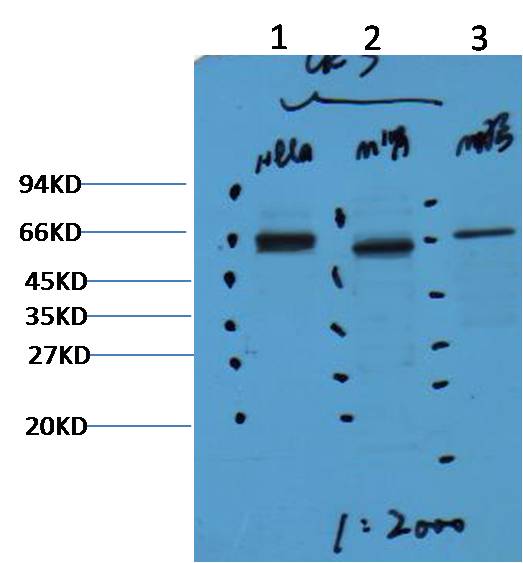 Western blot analysis of 1) Hela, 2)Mouse Kidney, 3) Mouse Brain with CK7 mAb diluted at 1:2,000.