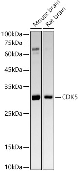 Western blot analysis of various lysates, using [KO Validated] CDK5 Rabbit mAb  at1:2000 dilution.
Secondary antibody: HRP Goat Anti-Rabbit IgG   at 1:10000 dilution.
Lysates/proteins: 25μg per lane.
Blocking buffer: 3% nonfat dry milk in TBST.
Detection: ECL Basic Kit .
Exposure time: 180s.