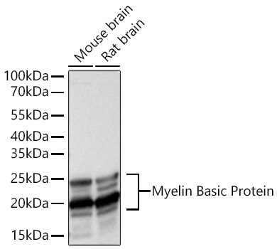 Western blot analysis of various lysates using Myelin Basic Protein Rabbit mAb at 1:3500 dilution incubated overnight at 4℃.
Secondary antibody: HRP-conjugated Goat anti-Rabbit IgG (H+L) at 1:10000 dilution.
Lysates/proteins: 25 μg per lane.
Blocking buffer: 3% nonfat dry milk in TBST.
Detection: ECL Basic Kit (RM00020).
Exposure time: 5s.