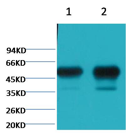 Western blot analysis of 1) Mouse Brain tissue, 2) Rat Brain tissue with diluted at 1:100,000.