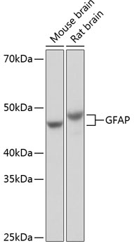 The multiplex IHC analysis on paraffin-embedded Mouse brain tissue using the following specific primary antibodies and tyramide signal amplification (TSA) reagents (RK05903) : NeuN Rabbit mAb (A19086, 1:2000) with TSA-TYR-520 (Green), GFAP Rabbit mAb (A19058, 1:500) with TSA-TYR-570 (Red), and TMEM119 Rabbit mAb (A27143, 1:600) with TSA-TYR-690 (Yellow). DAPI (Blue) was used for nuclear staining. Prior to multiplex IHC staining, high-pressure antigen retrieval was performed using 0.01M citrate buffer at pH 6.0. The analysis was completed using a 20x objective lens.