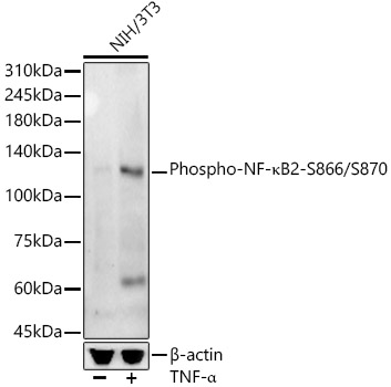 Western blot analysis of lysates from NIH/3T3 cells, using Phospho-NF-κB2-S866/S870 Rabbit mAb (AP1391) at 1:4000 dilution. NIH/3T3 cells were treated by TNF-α (20 ng/ml) at 37℃ for 30 minutes.
Secondary antibody: HRP-conjugated Goat anti-Rabbit IgG (H+L) (AS014) at 1:10000 dilution.
Lysates/proteins: 25μg per lane.
Blocking buffer: 3% nonfat dry milk in TBST.
Detection: ECL Basic Kit (RM00020).
Exposure time: 180s.